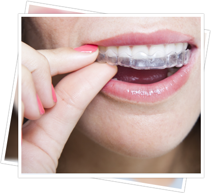 Tooth Whitening Banner